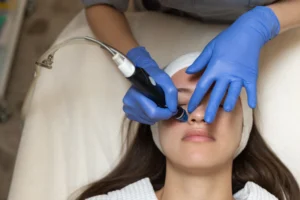 RF Microneedling | the wellmed | AZ